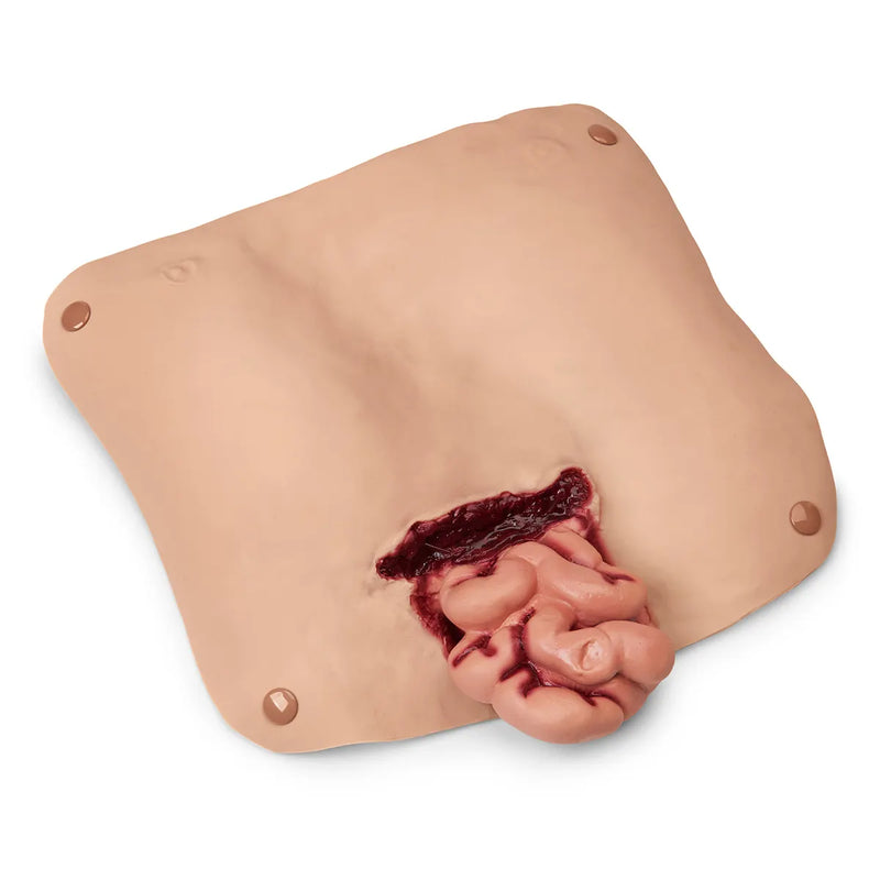 Load image into Gallery viewer, Basic Abdominal Wound
