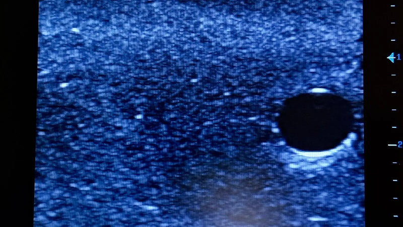 Tải hình ảnh vào trình xem Thư viện, Ultrasound Simulator with 2 Branched Veins