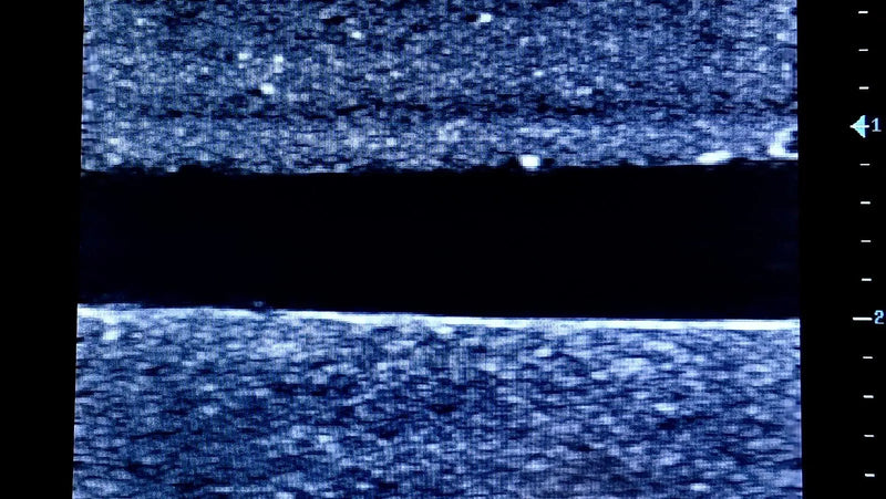 Tải hình ảnh vào trình xem Thư viện, Ultrasound Simulator with 2 Central Lines