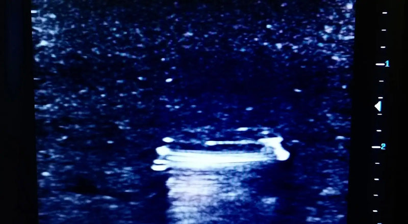 Tải hình ảnh vào trình xem Thư viện, Ultrasound Simulator with Foreign Bodies