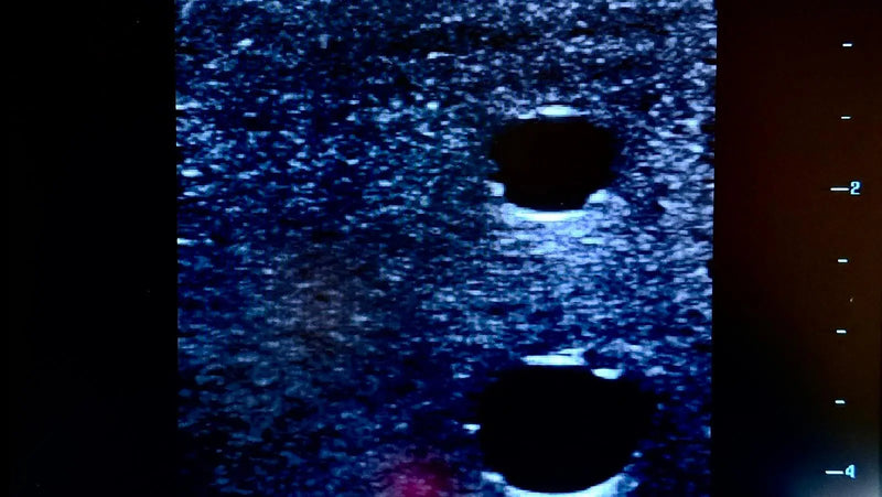 Tải hình ảnh vào trình xem Thư viện, Ultrasound Simulator with 4 Central Lines