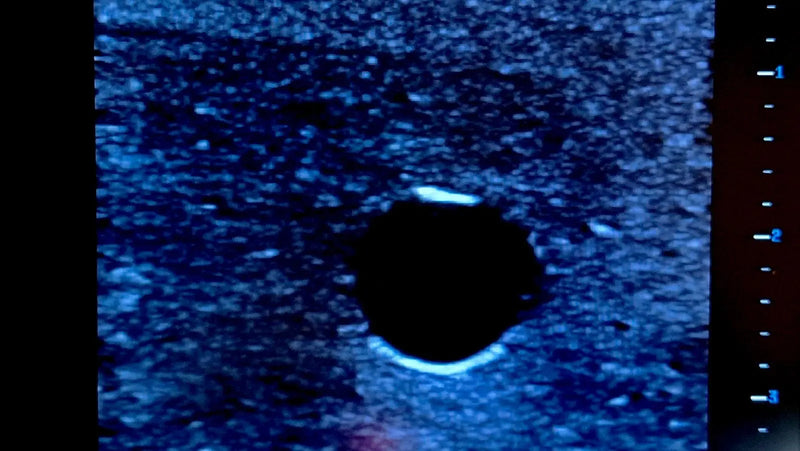 Cargue la imagen en el visor de la galería, Ultrasound Simulator for PICC Line/ Midline/ Seldinger