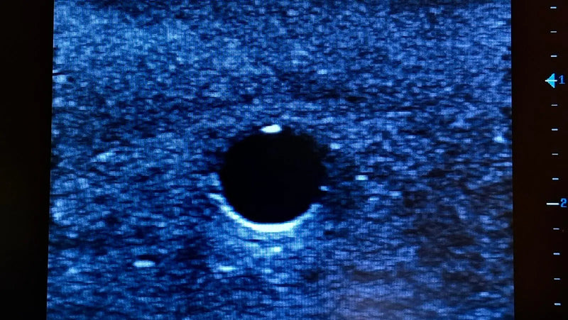 Cargue la imagen en el visor de la galería, Ultrasound Simulator for PICC Line/ Midline/ Seldinger