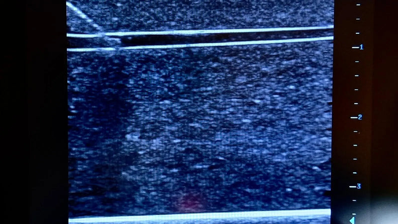 Cargue la imagen en el visor de la galería, Ultrasound Simulator for Radial Artery Catheterisation