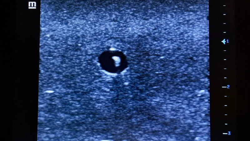 Cargue la imagen en el visor de la galería, Ultrasound Simulator for Radial Artery Catheterisation