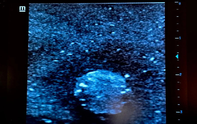 Tải hình ảnh vào trình xem Thư viện, Ultrasound Simulator with Breast Pathologies/Biopsy