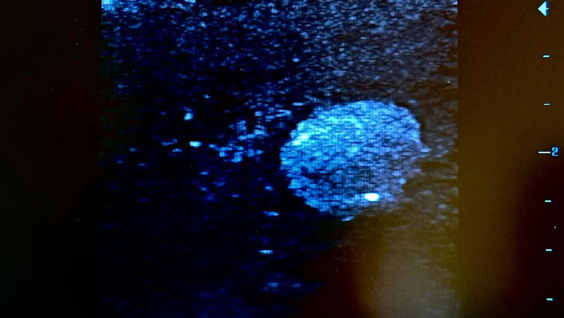 Tải hình ảnh vào trình xem Thư viện, Ultrasound Simulator with Breast Pathologies/Biopsy