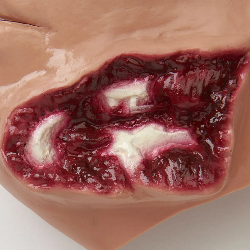 Carregar imagem no visualizador da Galeria, Ferida na Mandíbula com Sangramento