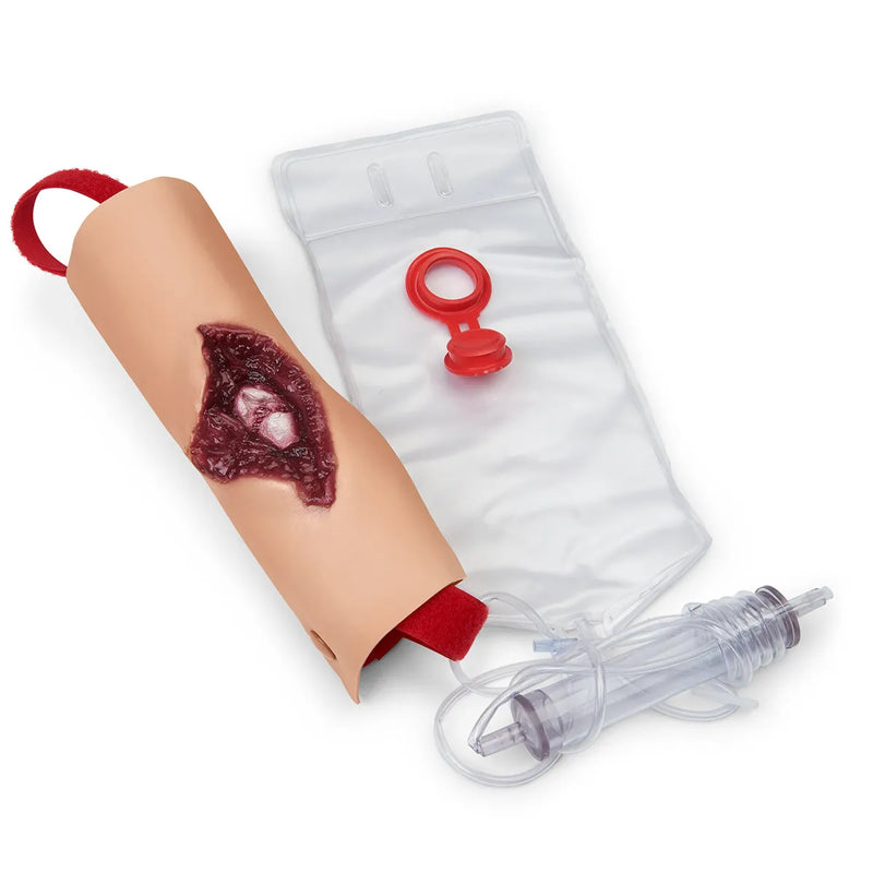 Załaduj obraz do przeglądarki galerii, Złamanie otwarte kości ramiennej