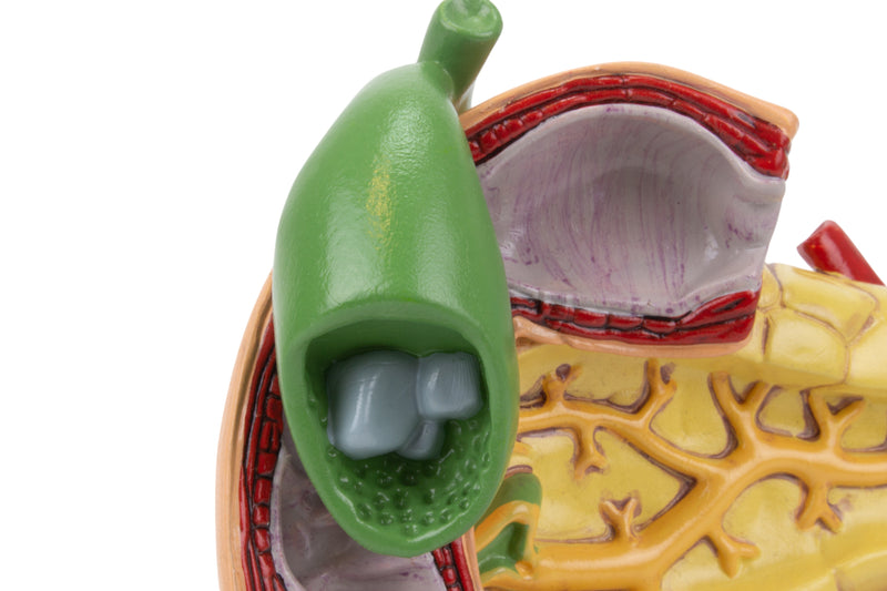 Load image into Gallery viewer, Pancreas, Spleen, and Gallbladder with Pathologies Model