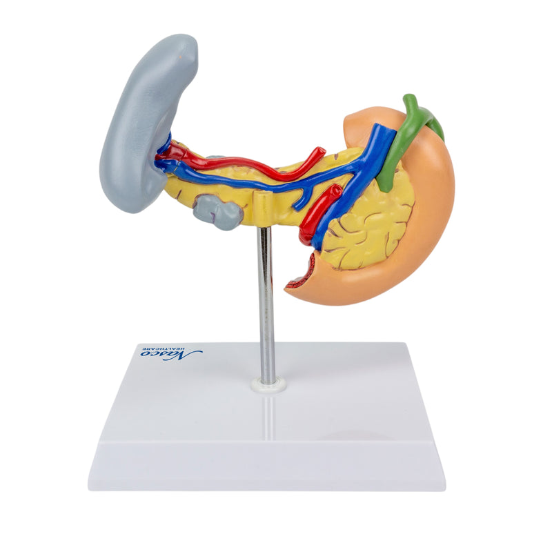 Load image into Gallery viewer, Pancreas, Spleen, and Gallbladder with Pathologies Model
