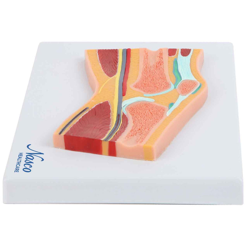 Load image into Gallery viewer, Knee Model, Median Section