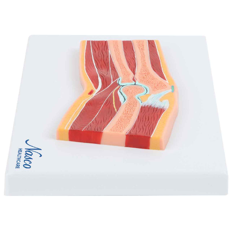 Load image into Gallery viewer, Elbow Model, Median Section