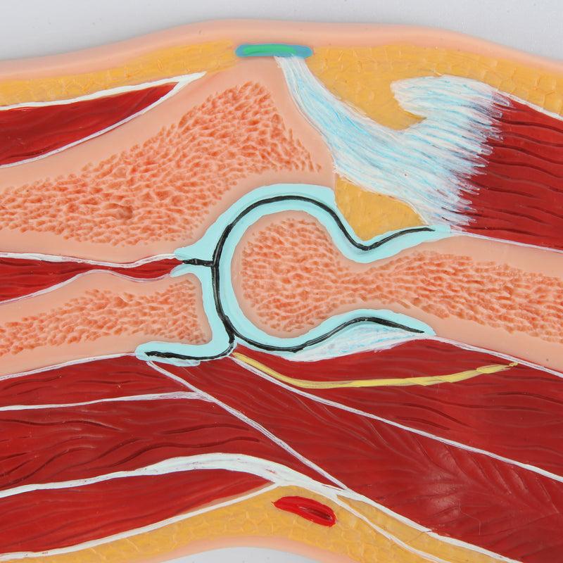 Load image into Gallery viewer, Elbow Model, Median Section