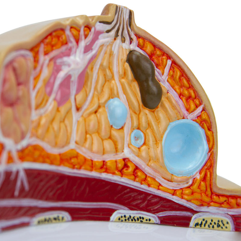 Load image into Gallery viewer, Breast Cross-Section with Pathologies Model