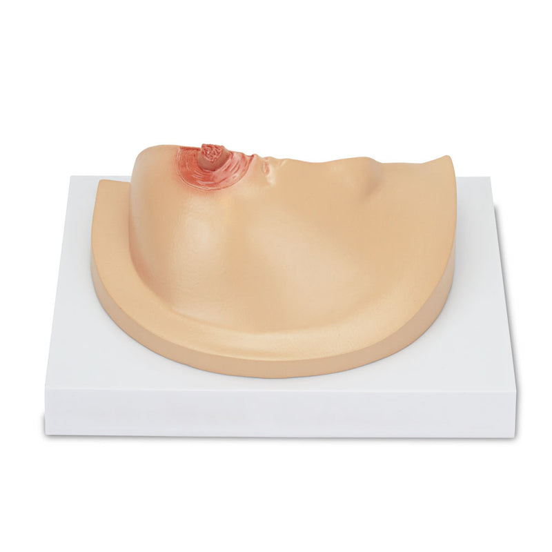 Load image into Gallery viewer, Breast Cross-Section with Pathologies Model