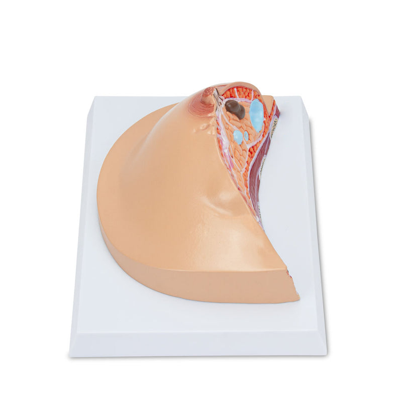 Load image into Gallery viewer, Breast Cross-Section with Pathologies Model