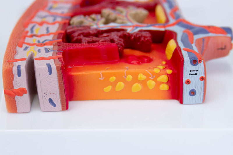 โหลดรูปภาพลงในโปรแกรมใช้ดูของ Gallery Placenta Cross-Section Model, 2X Enlarged