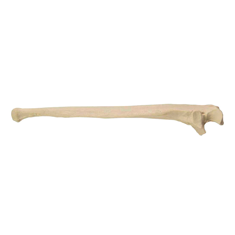 Load image into Gallery viewer, Ulna Model