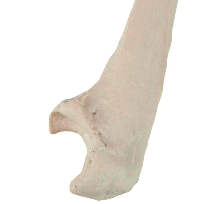 Load image into Gallery viewer, Ulna Model