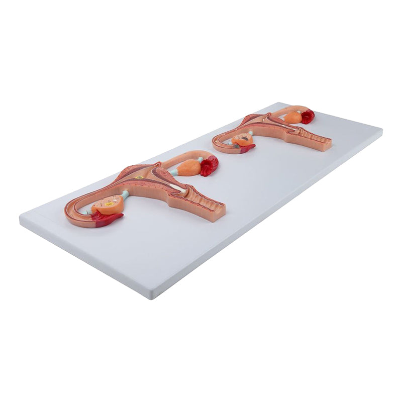 Load image into Gallery viewer, Uterus with Fertilization Process Model