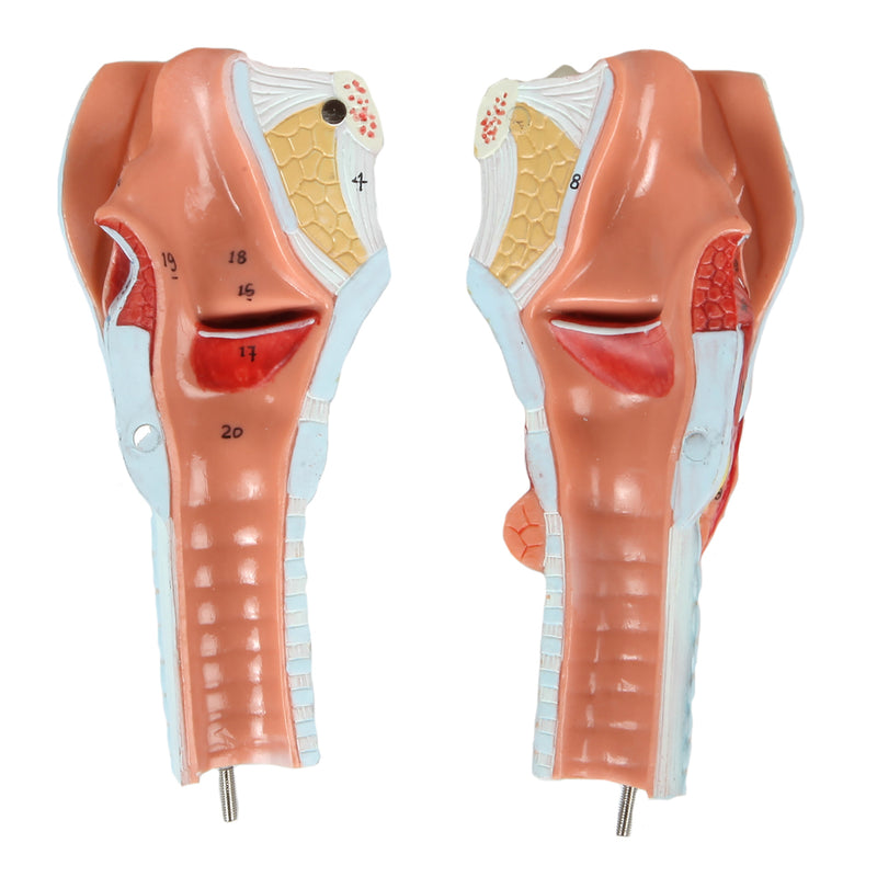 Load image into Gallery viewer, Bronchial Tree with Larynx Model