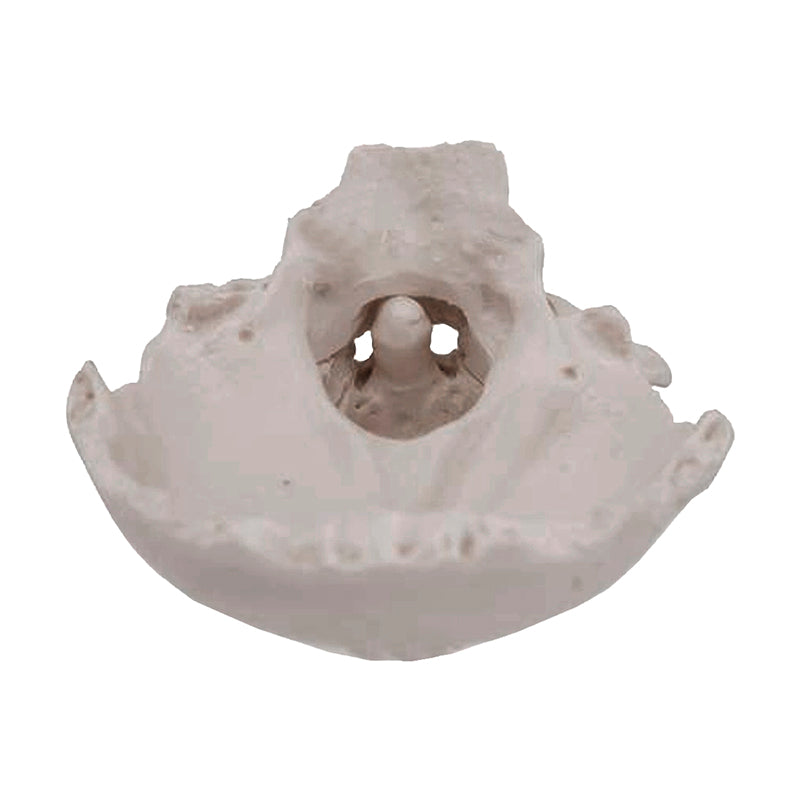 Load image into Gallery viewer, Atlas and Axis with Occipital Plate Model