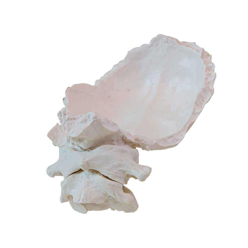 Load image into Gallery viewer, Atlas and Axis with Occipital Plate Model