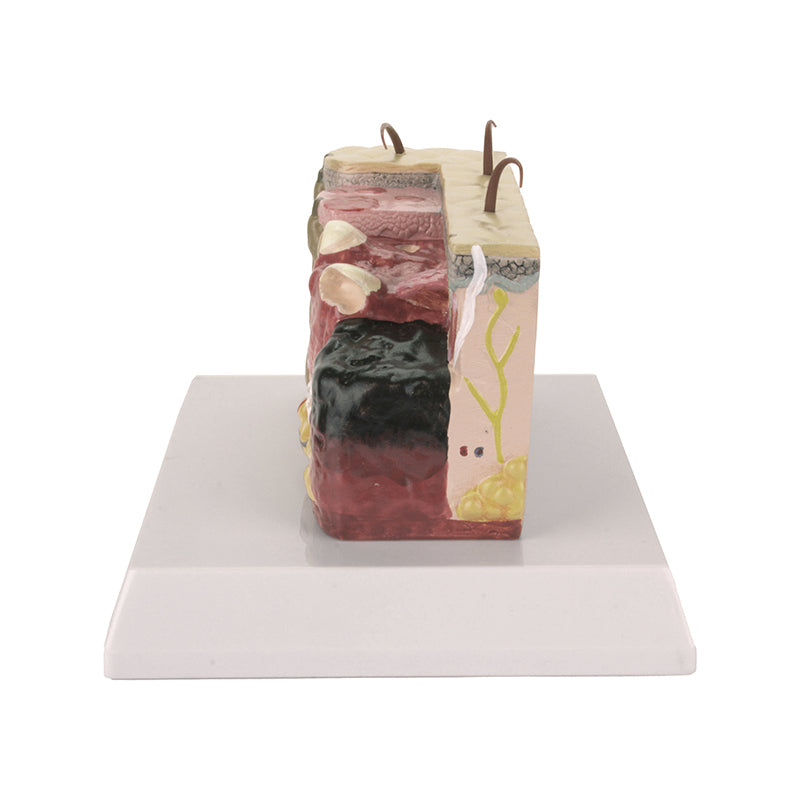 Load image into Gallery viewer, Skin Section with Burn Model, 30X Enlarged