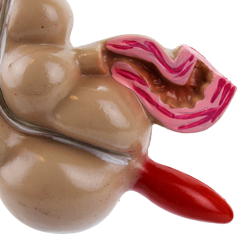 Load image into Gallery viewer, Colon with Intestinal Pathologies Model