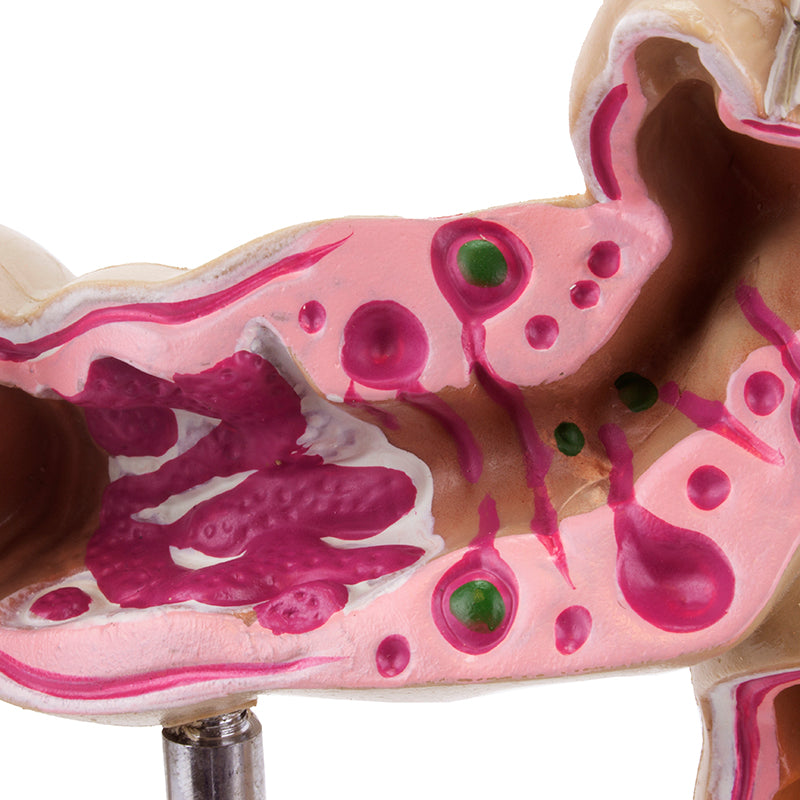 Load image into Gallery viewer, Colon with Intestinal Pathologies Model