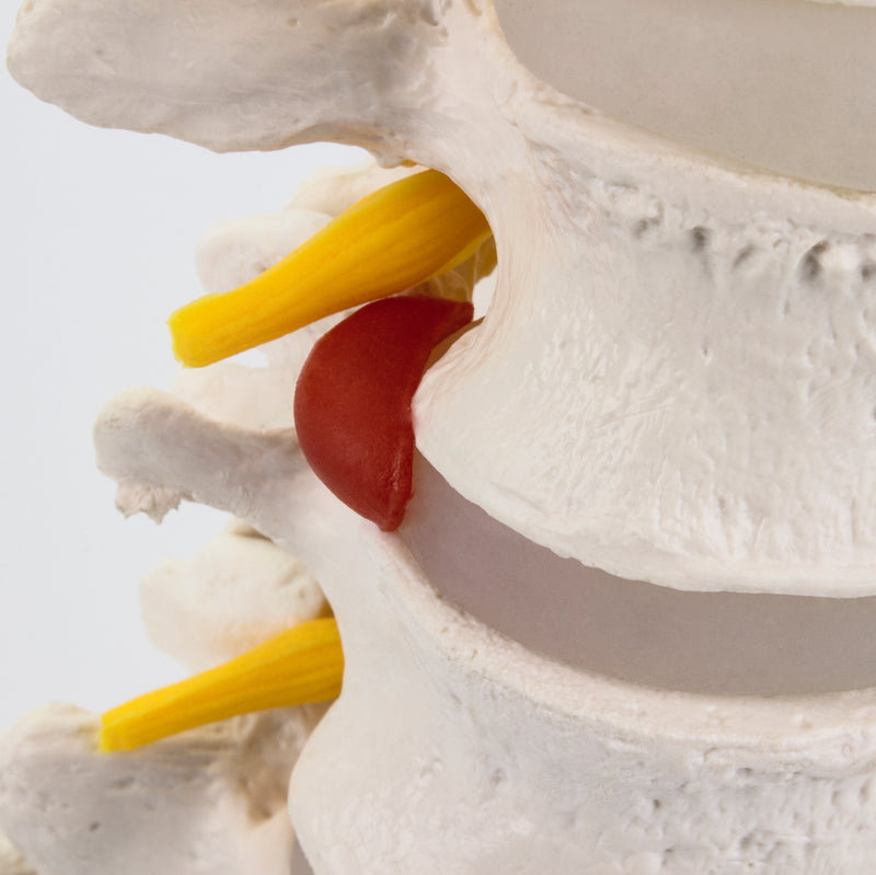 Загрузить изображение в просмотрщик галереи, Lumbar Spine Model