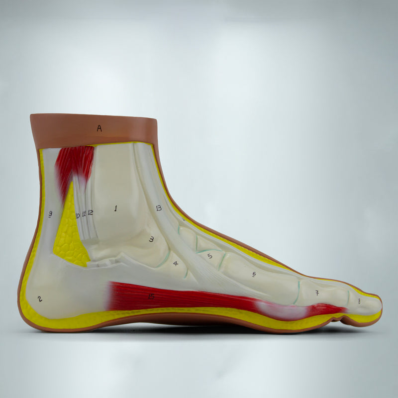 Load image into Gallery viewer, Normal and Abnormal Foot Models, Set of 3