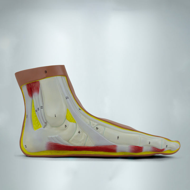 Load image into Gallery viewer, Normal and Abnormal Foot Models, Set of 3