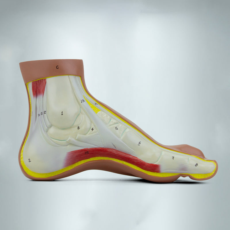 Load image into Gallery viewer, Normal and Abnormal Foot Models, Set of 3