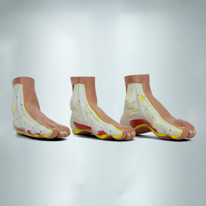 Load image into Gallery viewer, Normal and Abnormal Foot Models, Set of 3