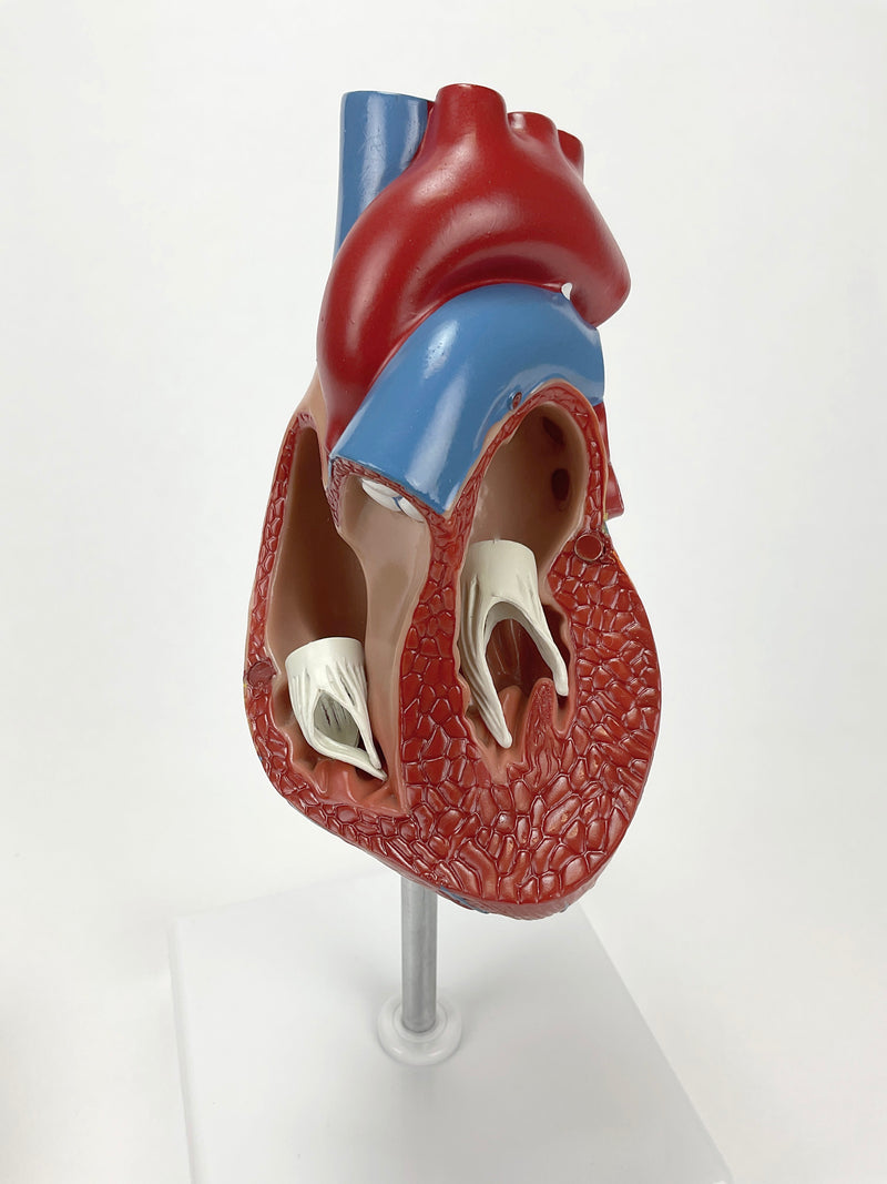 Load image into Gallery viewer, Classic Heart Model with Ventricular Hypertrophy