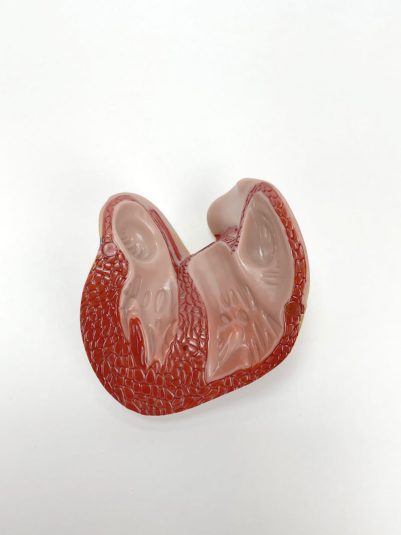 Load image into Gallery viewer, Classic Heart Model with Ventricular Hypertrophy