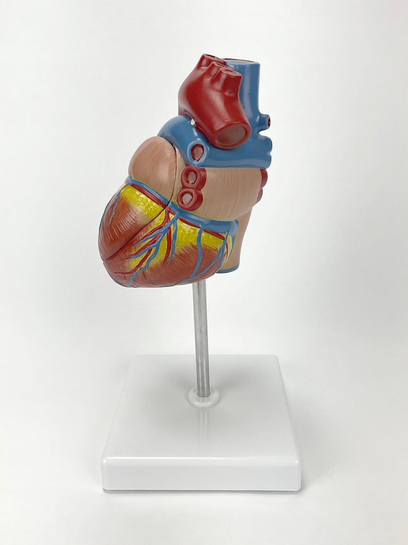 Load image into Gallery viewer, Classic Heart Model with Ventricular Hypertrophy