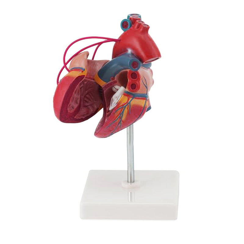 Load image into Gallery viewer, Classic Heart Model with Coronary Bypass