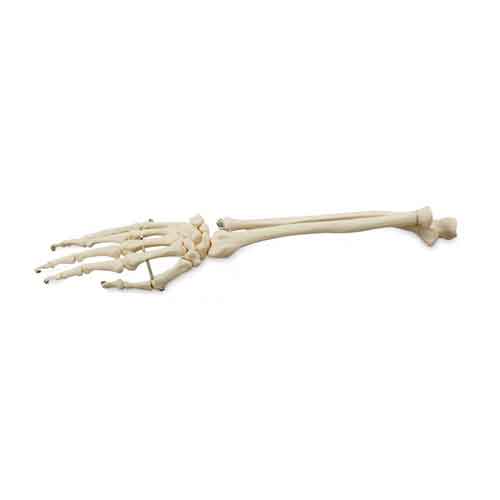 Load image into Gallery viewer, Hand with Ulna and Radius Model, Wire Mounted