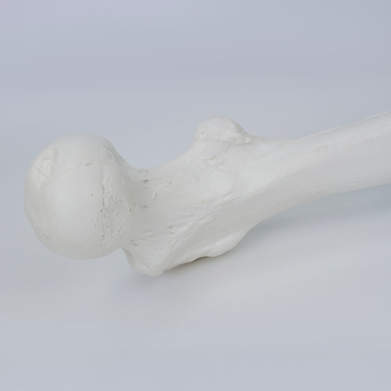 Load image into Gallery viewer, Leg with Foot Model, Wire Mounted