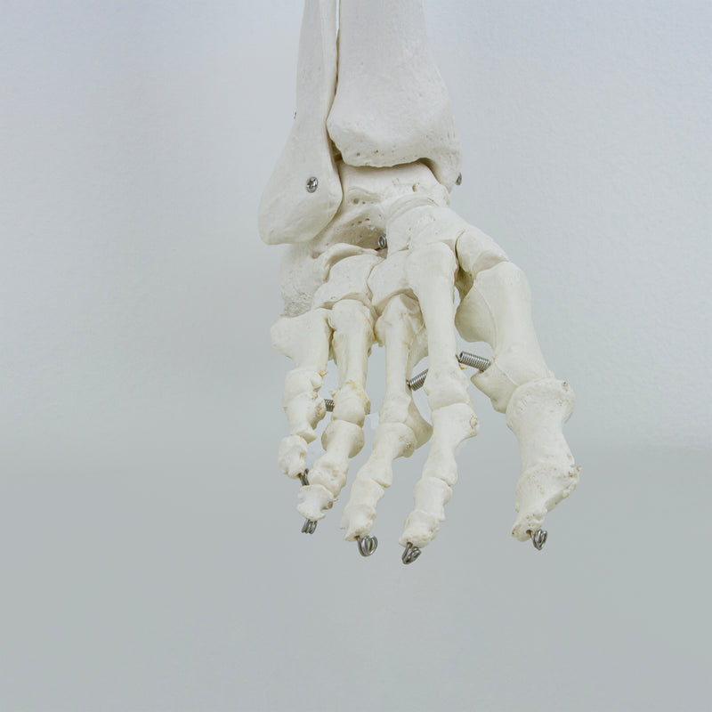 Load image into Gallery viewer, Leg with Foot Model, Wire Mounted