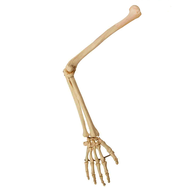 将图像加载到画廊查看器中,Arm Model, Wire Mounted