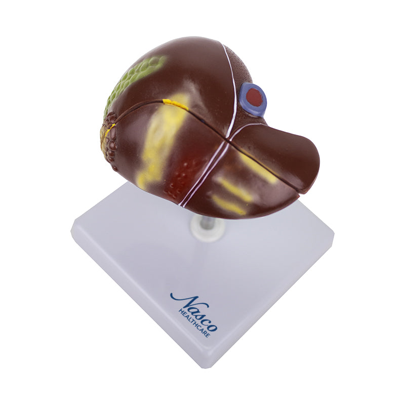 將圖像載入到圖庫檢視器中, Liver Section with Pathology Model, 2 Parts