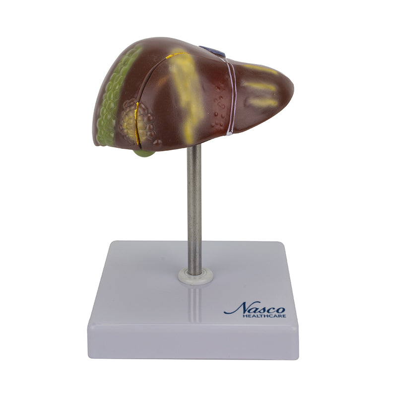 將圖像載入到圖庫檢視器中, Liver Section with Pathology Model, 2 Parts