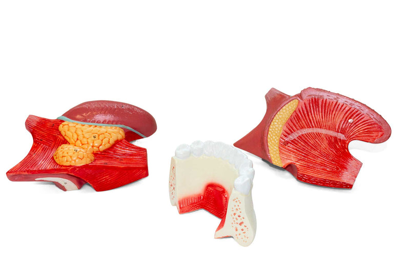 Load image into Gallery viewer, Tongue Model, 2.5X Enlarged, 3 Parts