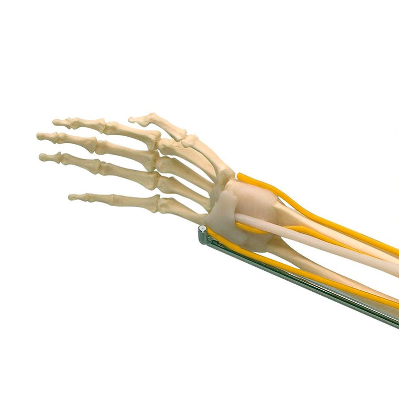 Load image into Gallery viewer, Elbow with Muscles Model