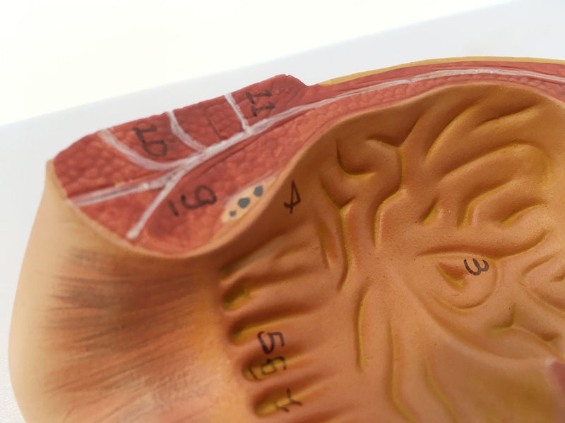 Load image into Gallery viewer, Rectum Cross-Section Model, 3X Enlarged