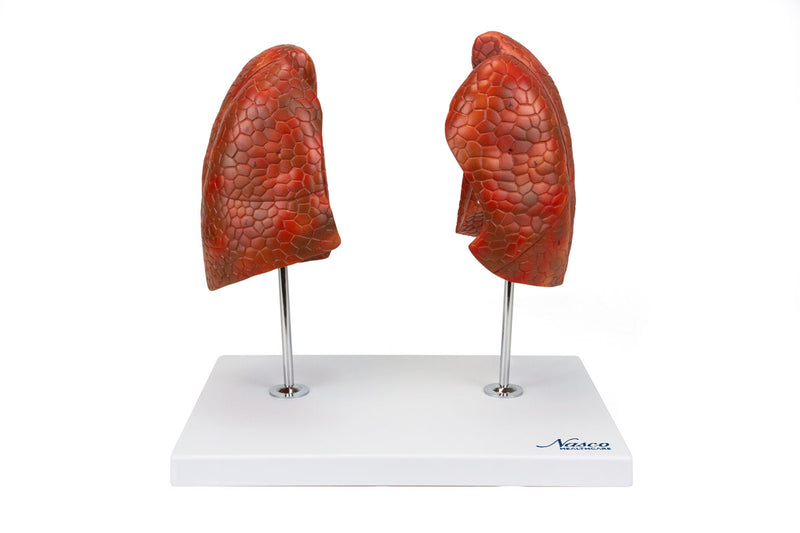 Load image into Gallery viewer, Lung Model, 4 Parts